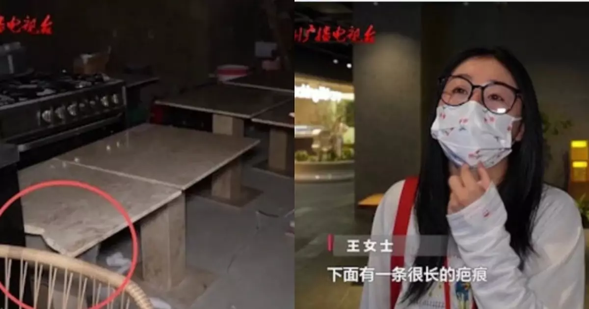 餐廳大理石檯面斷裂致女兒臉部受傷 貴陽女稱索賠遭老闆諷刺：去韓國整容