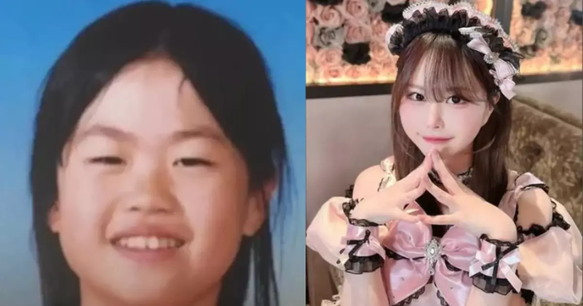 日本人氣YouTuber公開整形前後對比照 由自卑到坦然做自己引網民共鳴