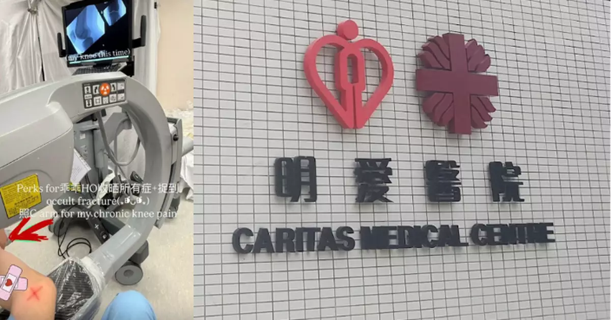 明愛醫院實習醫生擅用X光機自拍膝蓋 再放IG炫耀稱「福利」遭紀律處分