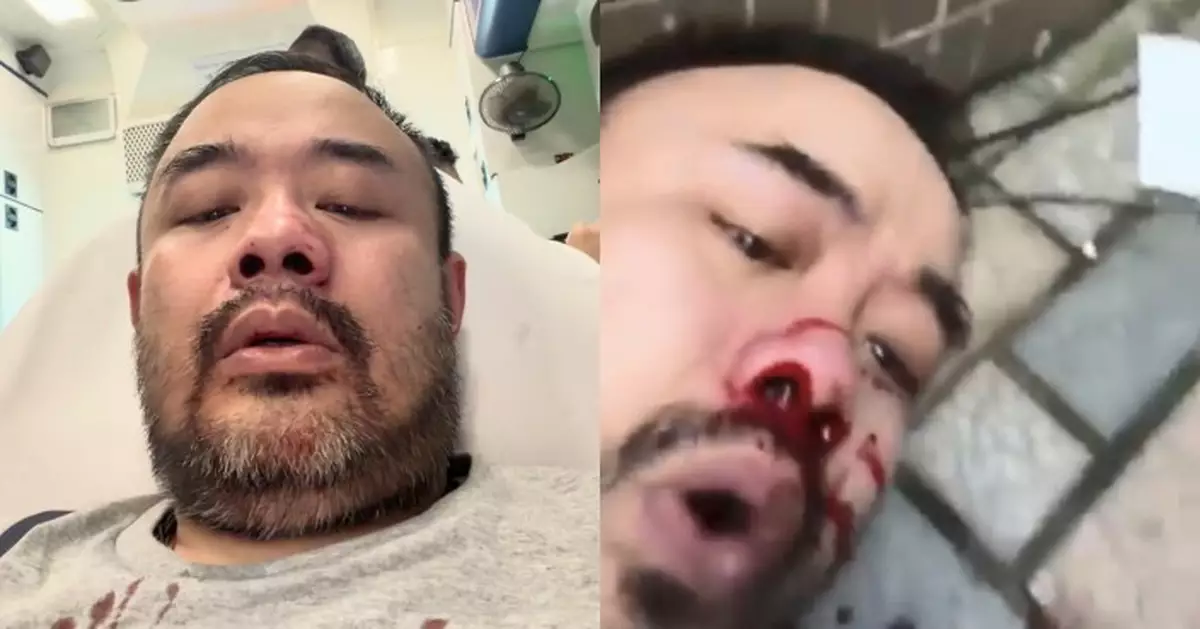 邵子風直播遇襲遭拳毆 另一YouTuber涉施襲被捕
