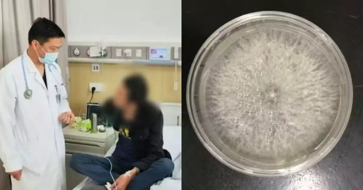 黃梅天霉菌滋生易傷肺 寧波夫婦吸霉菌孢子雙肺現大片陰影 老翁咳喘3月不癒
