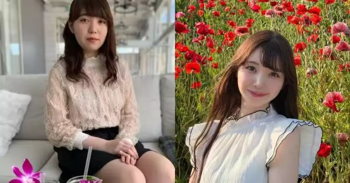 27歲逆齡後生過17歲？日女護理師公開10年前後對比照大方承認整形