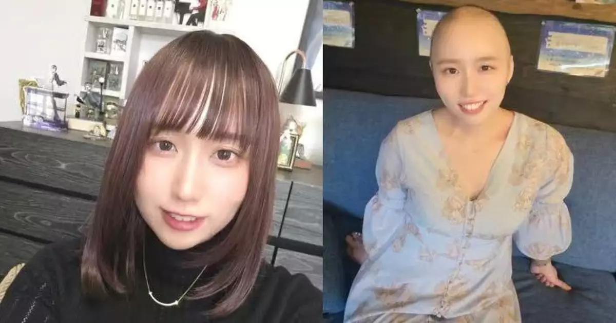 罹患大腸癌4期 日女網紅主動剃光長髮記錄抗癌歷程坦言「更像自己」