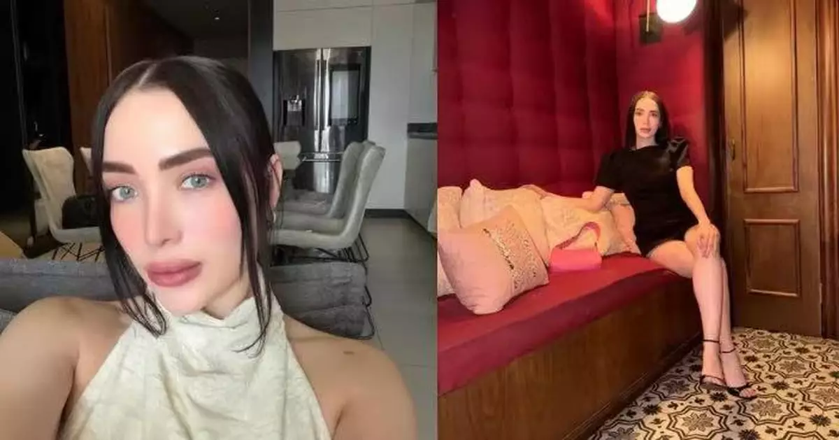 4月才痛失父親祖父 墨西哥美妝網紅整形手術突發併發症不治遺6歲幼女