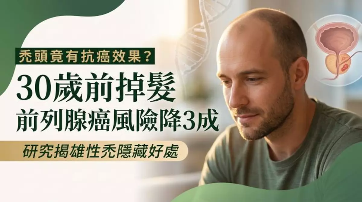 雄性禿意外藏好處！研究揭：男性30歲前掉髮「1患癌風險降3成」