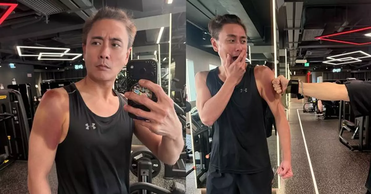 黃宗澤Gym房自爆「七傷拳」瘀傷 半臂紫黑嚇親網民