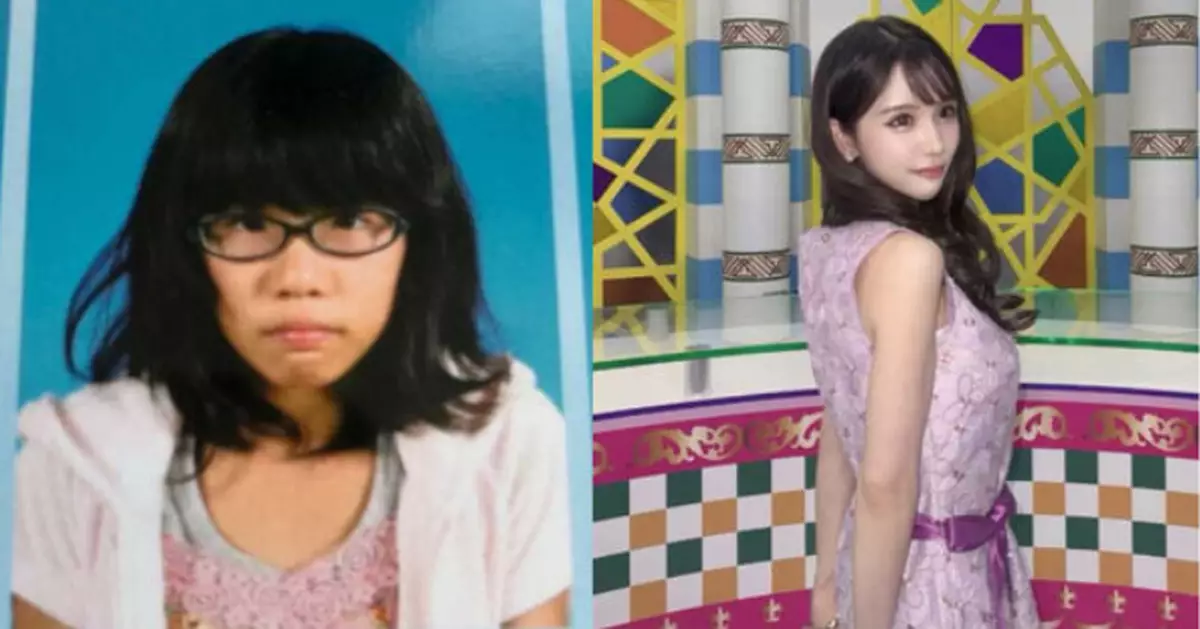 童年因外貌遭嘲笑 日女花140萬整形變身模特兒更參演Netflix劇集