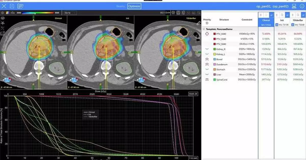 Radformation OptiPlan獲FDA擴大許可 自動化VMAT規劃美國應用