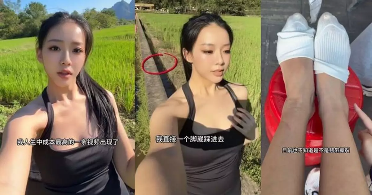 梁嘉瑩桂林拍片踩空 右腳踝腫成「大饅頭」恐骨裂