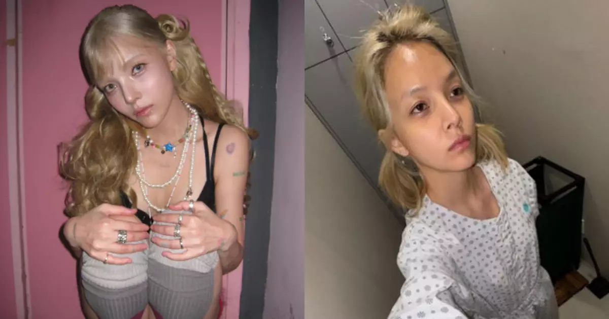前AOA智珉突上傳醫院病服照 曾自曝靠酒精入睡粉絲憂身心狀況