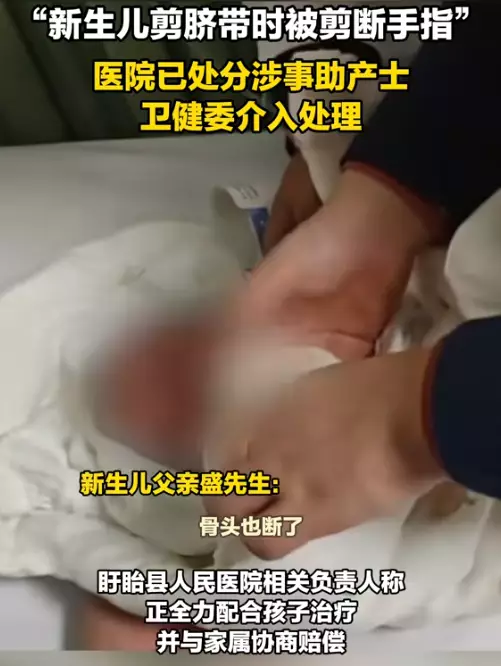 江蘇助產士為剖腹產男嬰剪臍帶時誤斷其中指。影片截圖