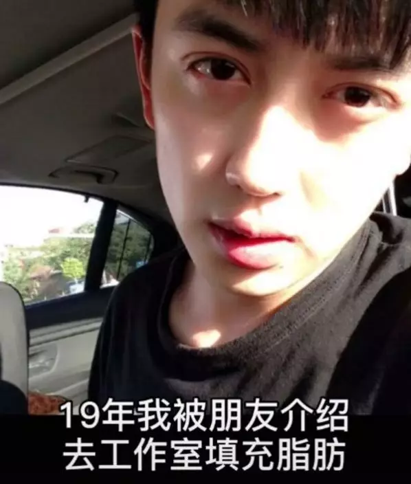 金大威整容前樣貌。網圖