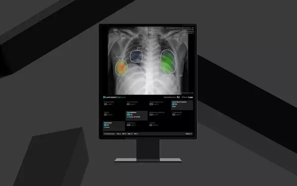 Lunit Launches Enhanced Lunit INSIGHT CXR4, Secures CE MDR Certification for Expanded AI Capabilities