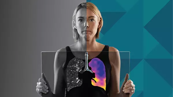 4DMedical Receives TGA Approval for CT:VQ™, Bringing Non-Contrast Ventilation-Perfusion Imaging to Australia