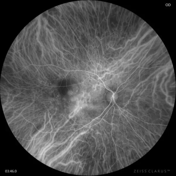 ZEISS expands DORC portfolio and further strengthens digital footprint with improved workflow efficiency and digital visualization