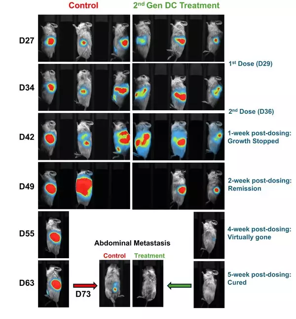 Lunai Bioworks achieves complete regression of both primary and metastatic pancreatic tumors in preclinical humanized models, marking a breakthrough in allogeneic cancer immunotherapy