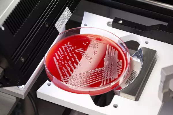 FDA 510(k) Clearance Establishes Broad Intended Use for Copan's PhenoMATRIX®, Expanding Clinical Microbiology Capabilities