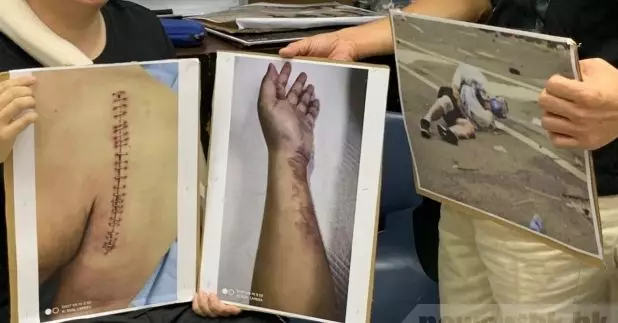 6名在近月反修例示威中受傷或被捕的市民，質疑警方在執法過程中濫權。（陳傲琪攝）