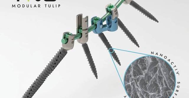 Xenix Medical Announces FDA Clearance of NanoACTIV™ Surface Technology for Its Riva® Posterior Fixation System