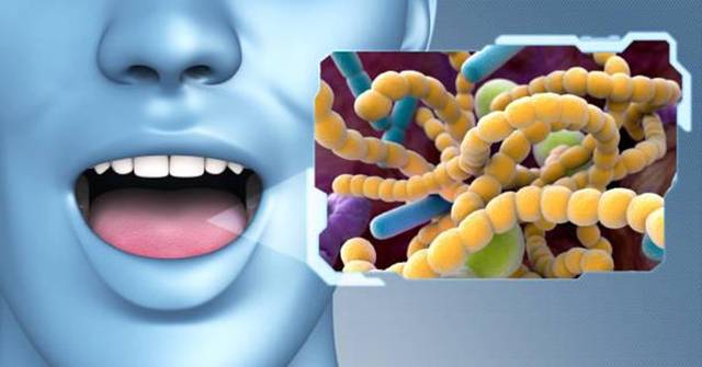 Gum Disease and Oral Bacteria Linked to Dementia and Alzheimer’s Disease: Studies