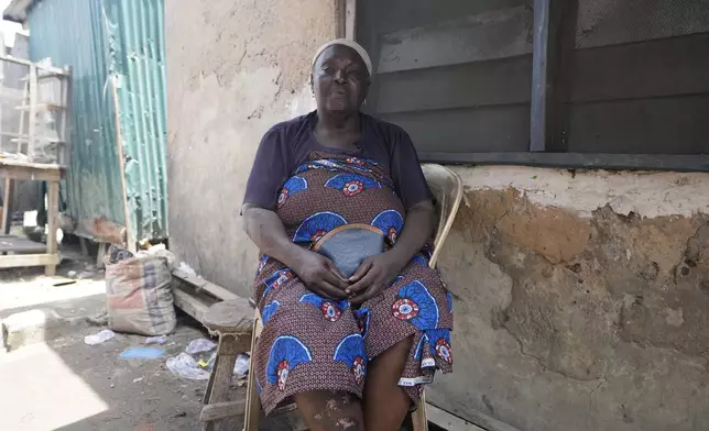 Funmilayo Kotun, 66-years-old, a malaria patient is photographed outside her house in Makoko neighbourhood of Lagos, Nigeria, Saturday, April 20, 2024. When cases of locally transmitted malaria were found in the United States last year, it was a reminder that climate change is reviving the threat, or broadening the range, of some diseases. But across the African continent malaria has never left.(AP Photo/Sunday Alamba)