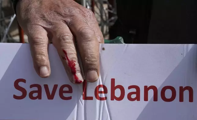 FILE - A retired soldier bleeds after trying to remove razor wire, set up in front of the government palace, as he holds a placard during a protest demanding better pay and living conditions, in Beirut, Thursday, March 30, 2023. Poverty in Lebanon tripled over the course of a decade during which the small Mediterranean country slid into a protracted financial crisis, the World Bank said Thursday, May 23, 2024. (AP Photo/Hussein Malla, File)