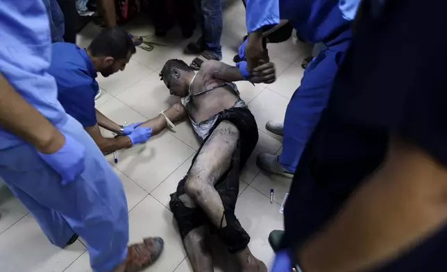 Palestinian medics treat a wounded youth in an Israeli bombardment on a residential building owned by the al-Telbani family in Al Zawaiyda area, at al-Aqsa Martyrs Hospital in Deir al-Balah, central Gaza Strip, late Monday, June 10, 2024. (AP Photo/Saher Alghorra)