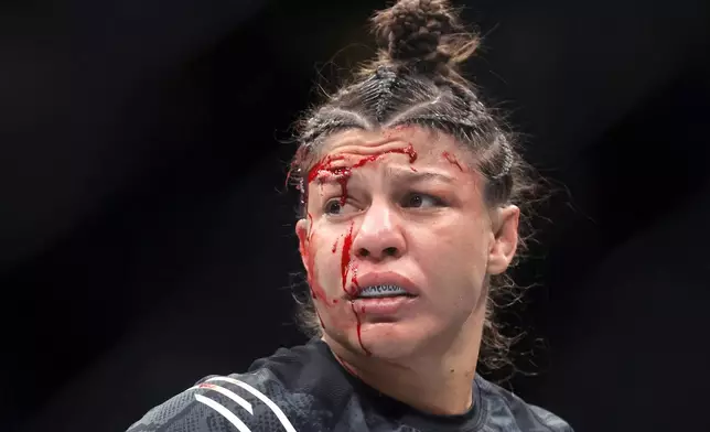 Mayra Bueno Silva bleeds after being hit by an elbow during the second round of a bantamweight mixed martial arts bout against Macy Chiasson during UFC 303, Saturday, June 29, 2024, in Las Vegas. (Steve Marcus/Las Vegas Sun via AP)