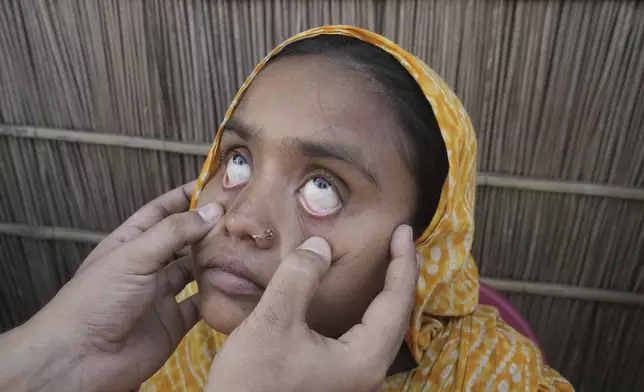 A heart officer checks the eyes of 25-year-old Jahanara Khatoon, who is at full-term pregnancy, outside her home in Sandoh Khaiti Char, in the northeastern Indian state of Assam, Wednesday, July 3, 2024. (AP Photo/Anupam Nath)