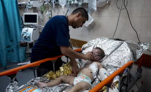 Palestinian Child Siwar Abdel-Hadi, 2, wounded in the Israeli bombardment of the Gaza Strip, receives medical treatment at a hospital in Deir al-Balah, Wednesday, July 24, 2024. Siwar Abdel-Hadi is the sole survivor in her family after an Israeli airstrike on her home in central Gaza killed her parents and three siblings. She becomes one of thousands of children orphaned in Israel's campaign in Gaza against Hamas. (AP Photo/Abdel Kareem Hana)