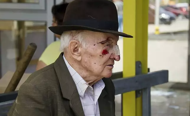 In this photo released by the Dnipro Regional Administration, an elderly injured man waits for medical treatment after Russia's missile attack in Dnipro, Ukraine, Wednesday, July 3, 2024. (Dnipro Regional Administration via AP)