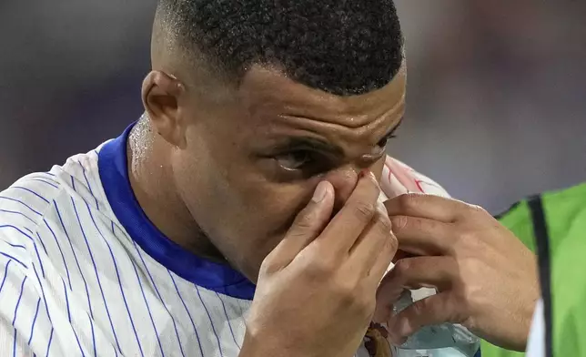 FILE - Kylian Mbappe of France holds his nose after suffering an injury during a Group D match between Austria and France at the Euro 2024 soccer tournament in Duesseldorf, Germany, on June 17, 2024. Kylian Mbappé has had more masks than goals at Euro 2024. Widely regarded as the heir to Lionel Messi and Cristiano Ronaldo as soccer's biggest icon, the France striker is struggling with his peripheral vision due to the protective face covering he has been fitted with since breaking his nose at the start of the European Championship. (AP Photo/Martin Meissner)