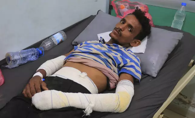 An injured Yemeni worker receives medical treatment at Al Thawrah hospital in Hodeidah, in western Yemen, following attacks, Saturday, July 20, 2024. The Israeli army said it has struck several Houthi targets in western Yemen following a fatal drone attack by the rebel group in Tel Aviv the previous day. (AP Photo)