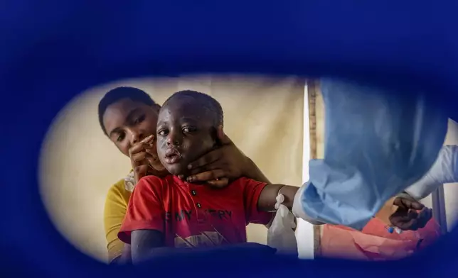 A health worker attends to a mpox patient, at a treatment centre in Munigi, eastern Congo, Monday, Aug. 19, 2024. Congo will receive the first vaccine doses to address its mpox outbreak next week from the United States, the country's health minister said Monday, days after the World Health Organization declared mpox outbreaks in Africa a global emergency. (AP Photo/Moses Sawasawa)