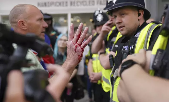 A man with blood on his hand speaks to a police officer during a protest in Nottingham Market Square, England, Saturday Aug. 3, 2024, following the stabbing attacks on Monday in Southport, in which three young children were killed. (Jacob King/PA via AP)