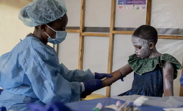 A health worker attends to Lucie Habimana, 13, a mpox patient, at a treatment centre in Munigi, eastern Congo, Friday, Aug. 16, 2024. (AP Photo/Moses Sawasawa)