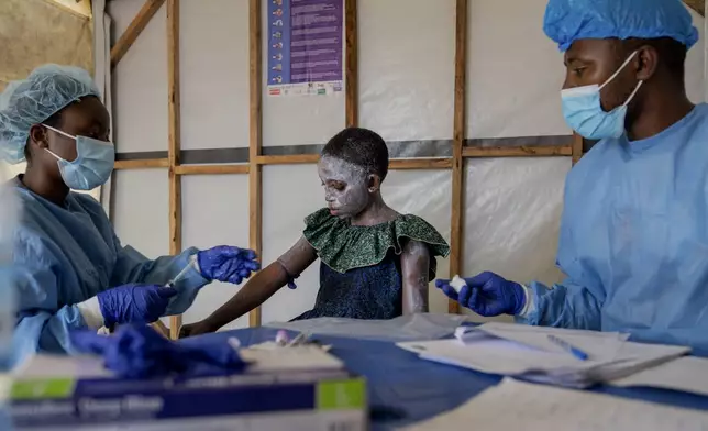 Health workers attend to Lucie Habimana, 13, a mpox patient, at a treatment centre in Munigi, eastern Congo, Friday, Aug. 16, 2024. (AP Photo/Moses Sawasawa)