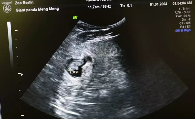 FILE -An embryo of a panda bear of pregnant panda Meng Meng is marked on the screen of an ultrasound machine at the panda enclosure at Berlin Zoo, Tuesday, Aug. 13, 2024. (Sebastian Gollnow/dpa via AP, File)