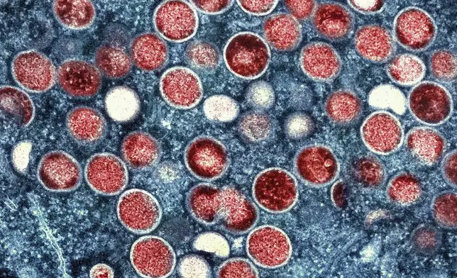 FILE - This undated image provided by the National Institute of Allergy and Infectious Diseases shows a colorized transmission electron micrograph of monkeypox particles (red) found within an infected cell (blue), cultured in the laboratory that was captured and color-enhanced at the NIAID Integrated Research Facility in Fort Detrick, Md. (NIAID via AP, File)