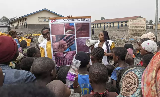 This photo supplied by MSF (Doctors Without Borders) dated May 31, 2023, shows health workers educating children on the symptoms of the mpox disease in Goma, Congo. (Augustin Mudiayi/Doctors Without Borders/Médecins Sans Frontières via AP)