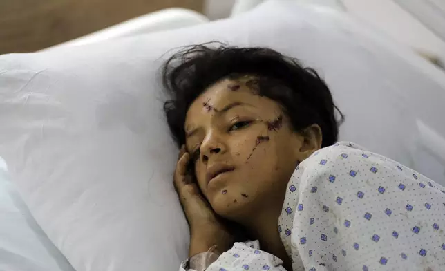 A wounded girl lies in a hospital bed in the southern village of Saksakieh, Lebanon, Tuesday, Sept. 24, 2024. (AP Photo/Mohammed Zaatari)