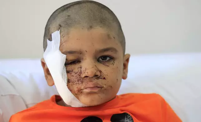 Ali Abdel Rahman Zorout, 5, who was wounded in an Israeli airstrike, poses at the Alaaeddine Hospital in Sarafand, south Lebanon, Thursday, Sept. 26, 2024. (AP Photo/Mohammed Zaatari)