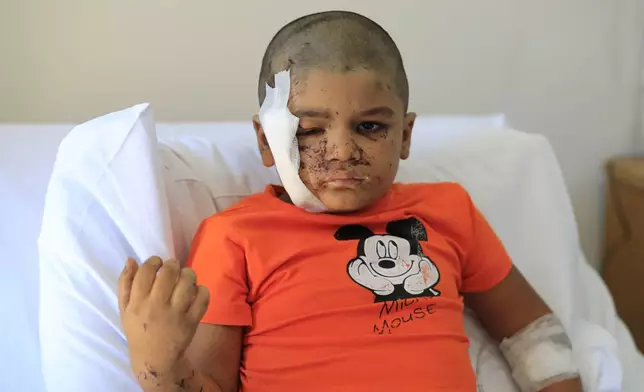 Ali Abdel Rahman Zorout, 5, who was wounded in an Israeli airstrike, poses for a picture at the Alaaeddine Hospital in Sarafand, south Lebanon, Thursday, Sept. 26, 2024. (AP Photo/Mohammed Zaatari)