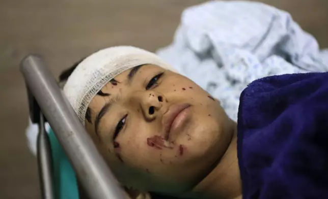 A wounded boy lies in a hospital bed in the southern village of Saksakieh, Lebanon, Tuesday, Sept. 24, 2024. (AP Photo/Mohammed Zaatari)