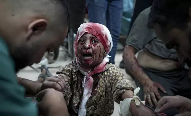 A Palestinian child wounded in the Israeli bombardment of the Gaza Strip is treated at a hospital in Deir al-Balah, Thursday, Oct. 10, 2024. (AP Photo/Abdel Kareem Hana)