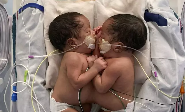 This undated photo provided by the Children’s Hospital of Philadelphia in October 2024 shows conjoined twins, Amari and Javar Ruffin, at the Children’s Hospital of Philadelphia. (Children’s Hospital of Philadelphia via AP)