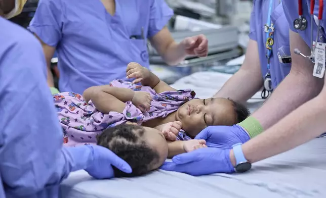 This photo provided by the Children’s Hospital of Philadelphia shows the hospital surgical team separating conjoined twins, Amari and Javar Ruffin, at the Children’s Hospital of Philadelphia, Aug. 21, 2024. (Ed Cunicelli/Children’s Hospital of Philadelphia via AP)