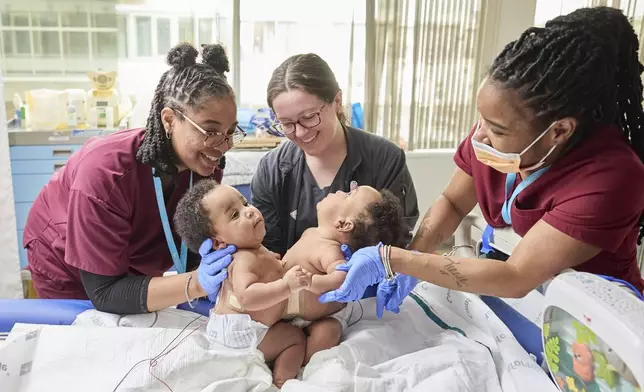 This photo provided by the Children’s Hospital of Philadelphia shows conjoined twins, Amari and Javar Ruffin, at the Children’s Hospital of Philadelphia, March 20, 2024. (Ed Cunicelli/Children’s Hospital of Philadelphia via AP)