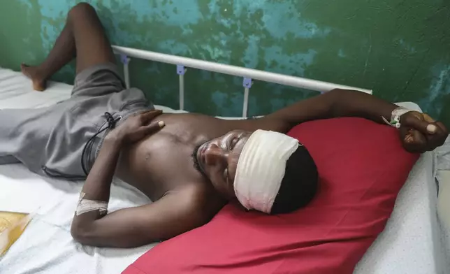 Germain Rivaldo, wounded by a bullet during armed gang attacks, lies on a bed at Saint Nicolas hospital in Saint-Marc, Haiti, Sunday, Oct. 6, 2024. (AP Photo/Odelyn Joseph)