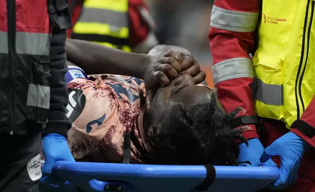 Torino's Duvan Zapata is carried off the pitch after being injured during the Serie A soccer match between Inter Milan and Torino at the San Siro Stadium, in Milan, Italy, Saturday, Oct. 5, 2024. (AP Photo/Antonio Calanni)